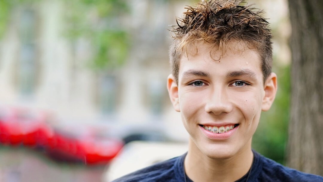 Smiling adolescent with metal braces treatment at Blackburn Orthodontics