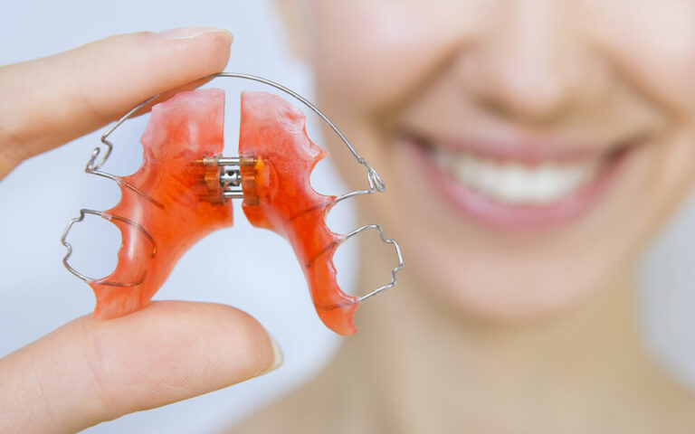 Orthodontic appliances (fixed and removable) at Blackburn Orthodontics